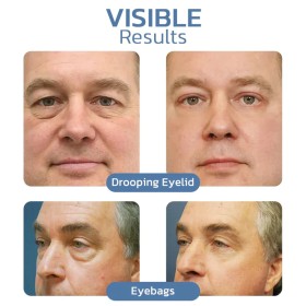 OPENEYES AWAKEN PEPTIDE LIFTING EYE GEL