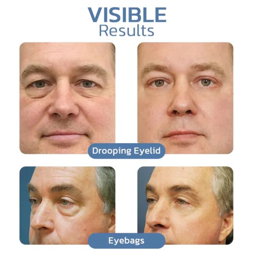 OPENEYES AWAKEN PEPTIDE LIFTING EYE GEL